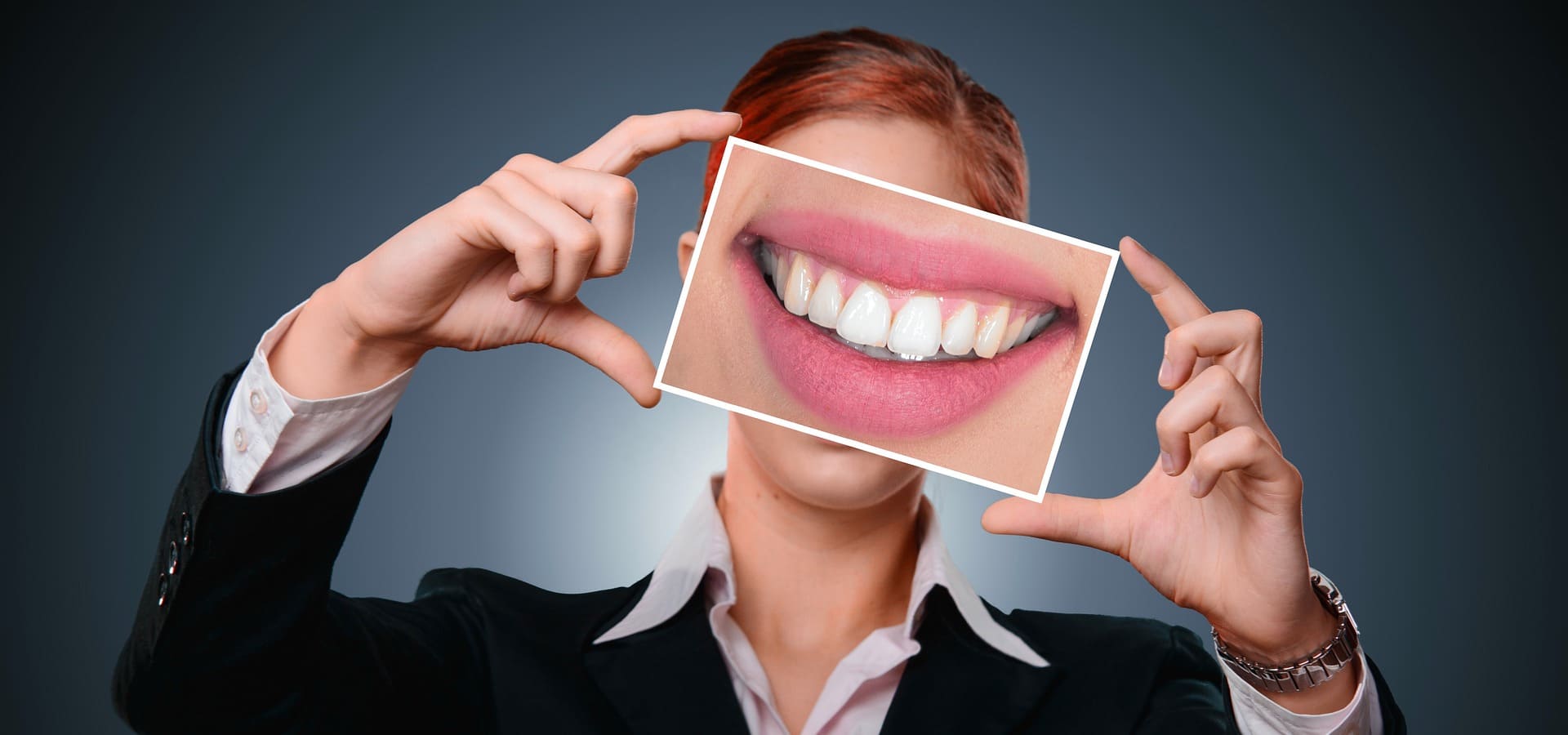 El blanqueamiento dental y su funcionamiento